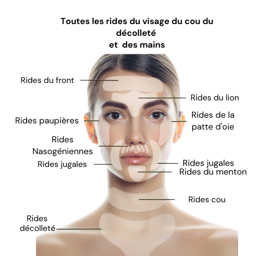 Anti-rides Galvalisse™