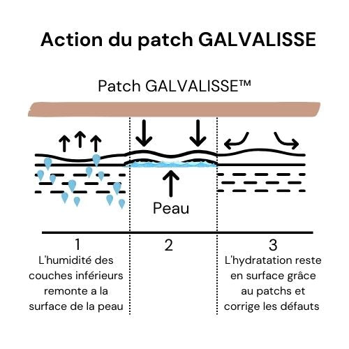 Anti-rides Galvalisse™